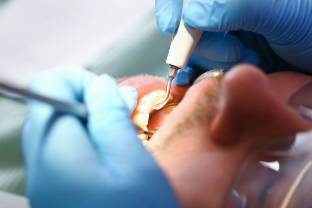 Best Walk-In Emergency Dentist in Amite City, LA