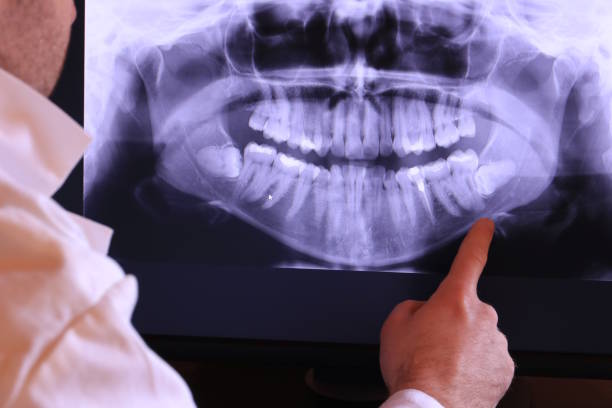Best Emergency Treatment for Toothache in Amite City, LA